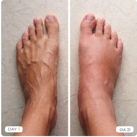 Comparação antes e depois — Jéssica, 43