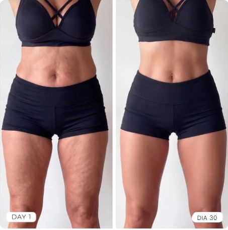 Comparação antes e depois — Sarah, 36
